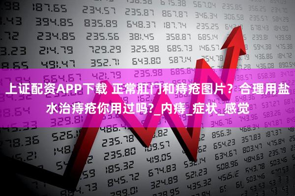 上证配资APP下载 正常肛门和痔疮图片？合理用盐水治痔疮你用过吗?_内痔_症状_感觉